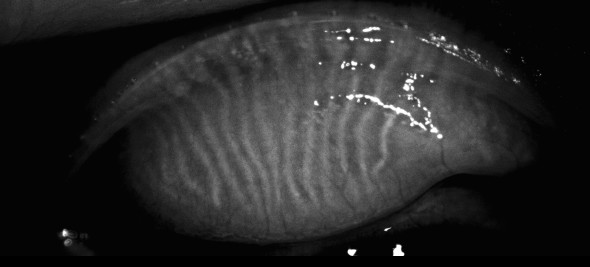 Before Treatment