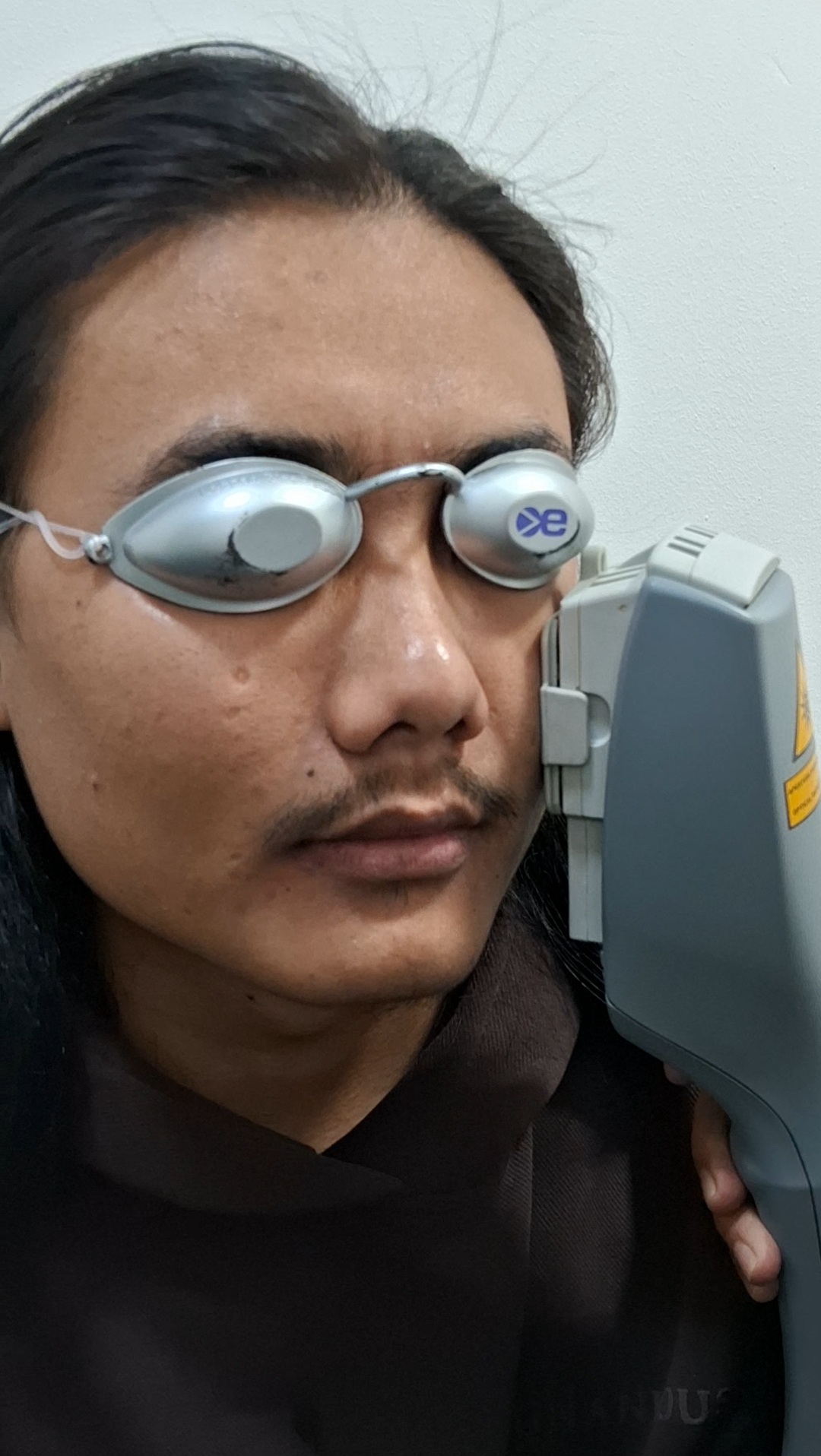 Dry Eye Services